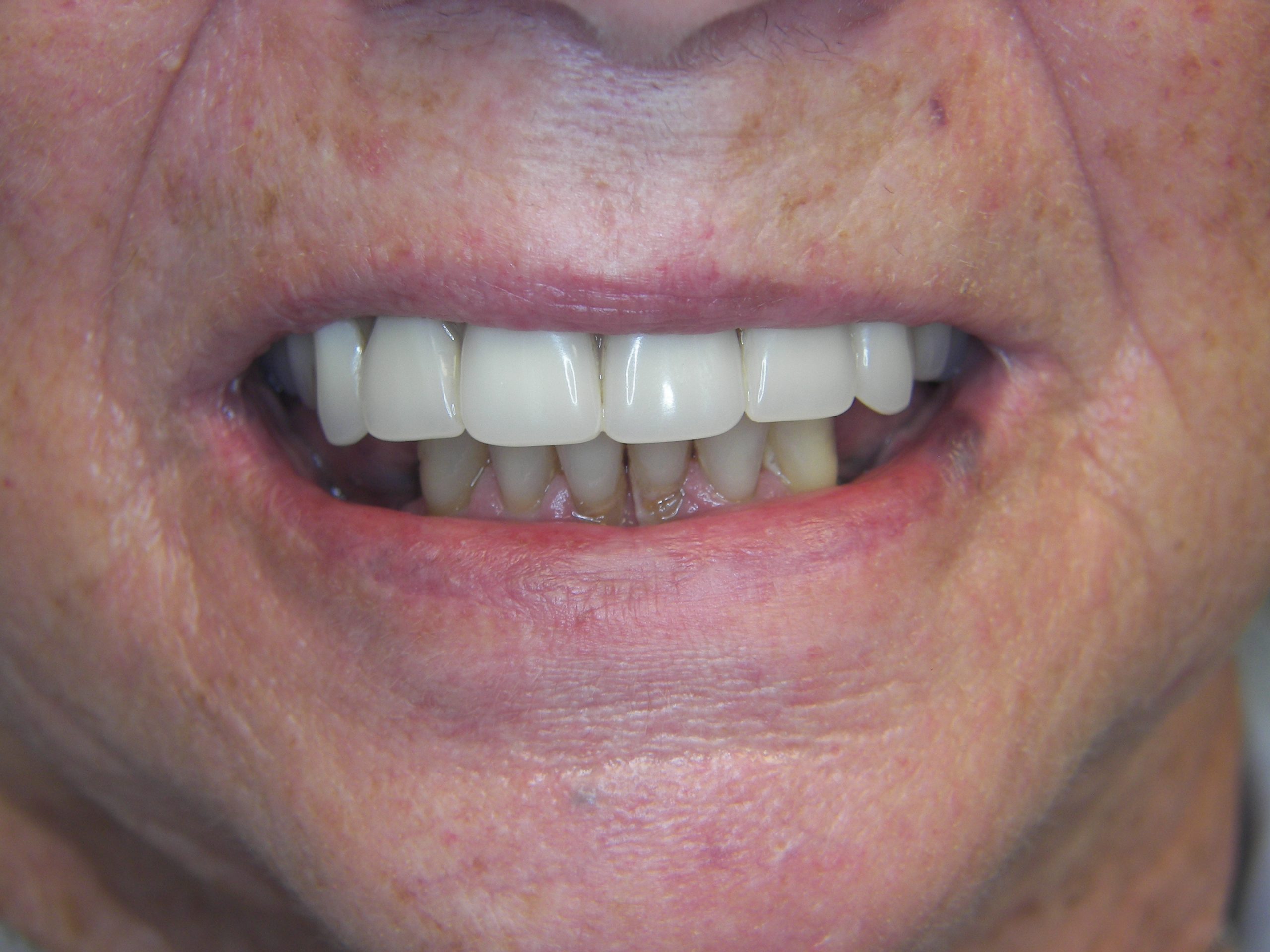 Smile Gallery