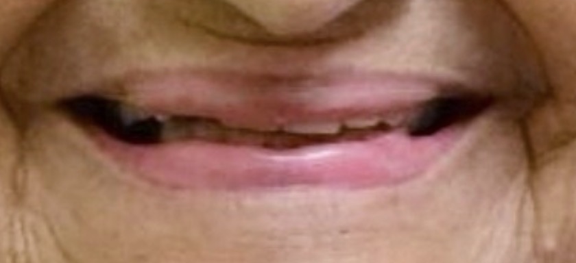 Smile Gallery